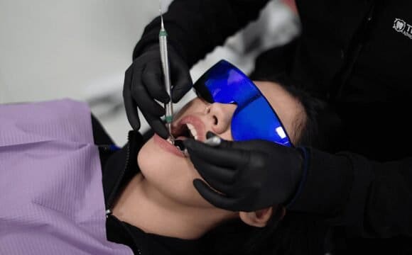 Tooth Extraction