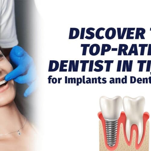 Discover the Top-Rated Dentist in Tijuana for Implants and Dental Crowns